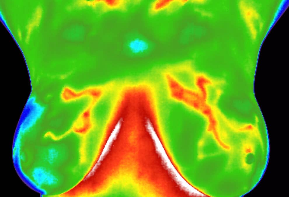 Breast Thermography versus Regulation Thermography